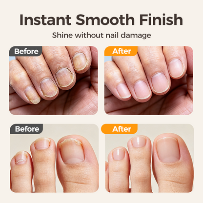 ✂️  50% OFF! 💅 2-in-1 Smart Electric Nail Clipper & Polisher 🌟